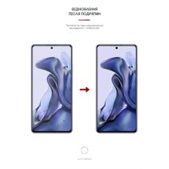 Пленка защитная Armorstandart Anti-spy Xiaomi 11T Фото 2
